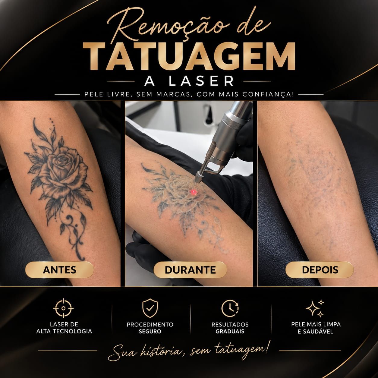 Remoção de tatuagem a laser